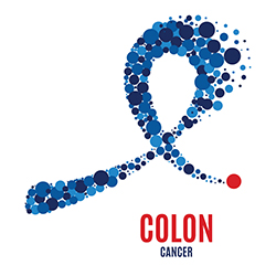 Quick Quiz: Colorectal Cancer Edition